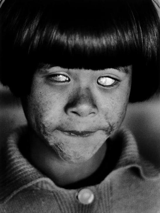 3. Глаза, которые видели ядерный взрыв в Хиросиме в мире, интересное, исторические кадры, подборка, редкие фото, снимки, события, фото