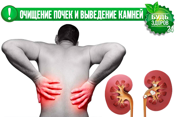 Картинки по запросу камней из почек