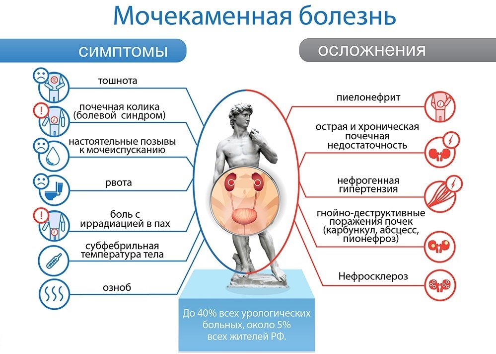 Мочекаменная болезнь — когда требуется госпитализация? мочекаменной, болезни, камней, почках, которые, этого, камни, образования, необходимо, просто, солей, предупредить, почек, богатых, больнице, продуктов, очень, ничего, различных, профилактикой