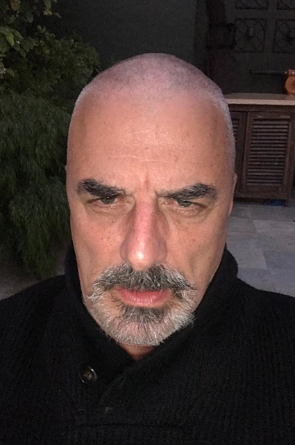 Крис Нот побрился налысо Крис Нот побрился налысо Было/Стало