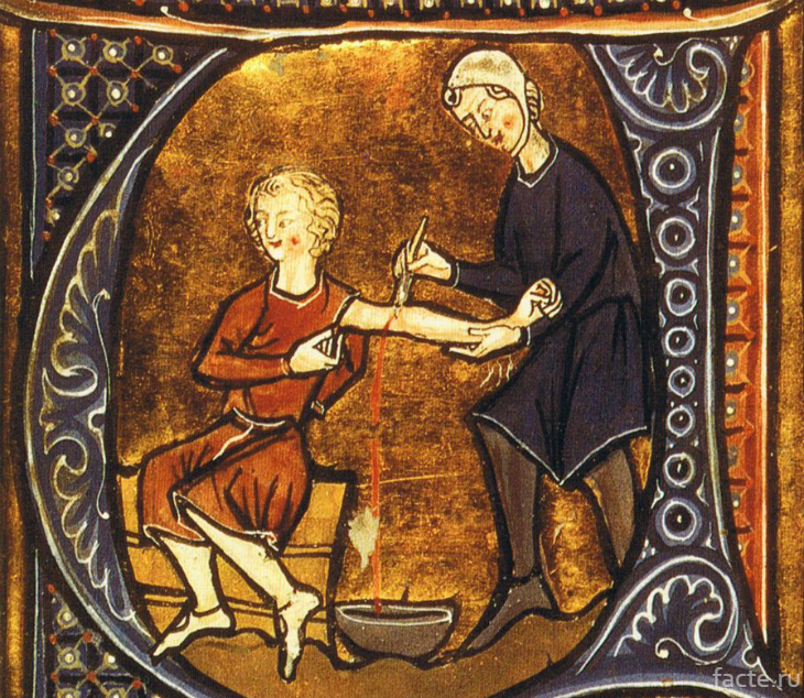 Средневековые методы лечения