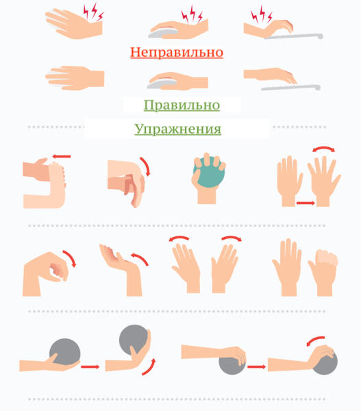 Как предотвратить туннельный синдром?: Упражнения для рук