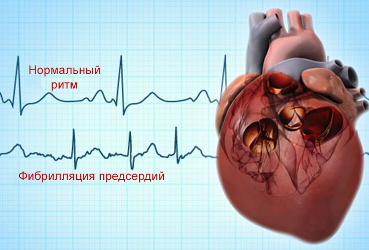 Рыбий жир может быть опасен: в чем вред биодобавки рыбий, журнале, рыбьего, людей, может, Омега3, принимать, принимающих, крови, которые, течение, повышает, количество, показали, некоторых, ртуть, кислот, организм, необходимо, возникновения