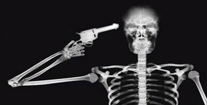 Самые известные номинанты Премии Дарвина 