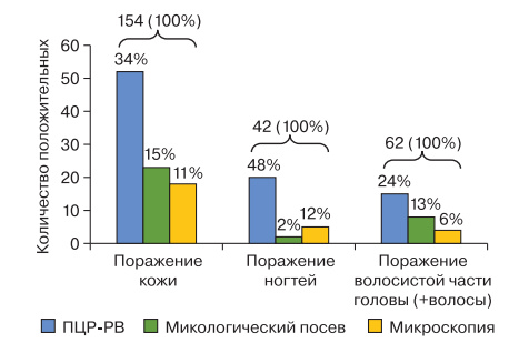 Прижать к ногтю. Симптомы и схемы лечения грибковых инфекций ногтей болезни,грибковые инфекции,здоровье и медицина