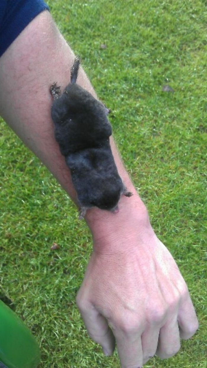 My Dad Sent Me A Picture With The Subject: I'm Worried About A Mole I Found On My Arm