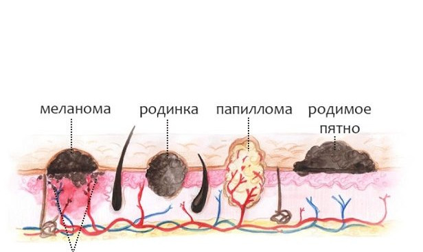 Похожее изображение