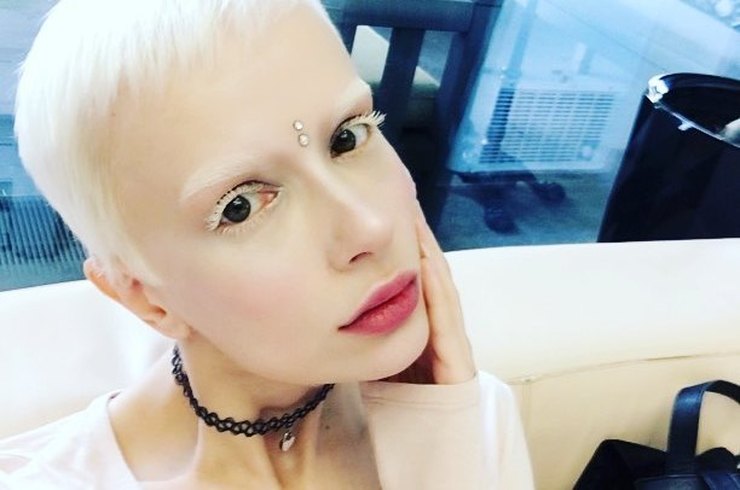 Девушка-альбинос из шоу «Холостяк» рассказала об особенностях своей болезни