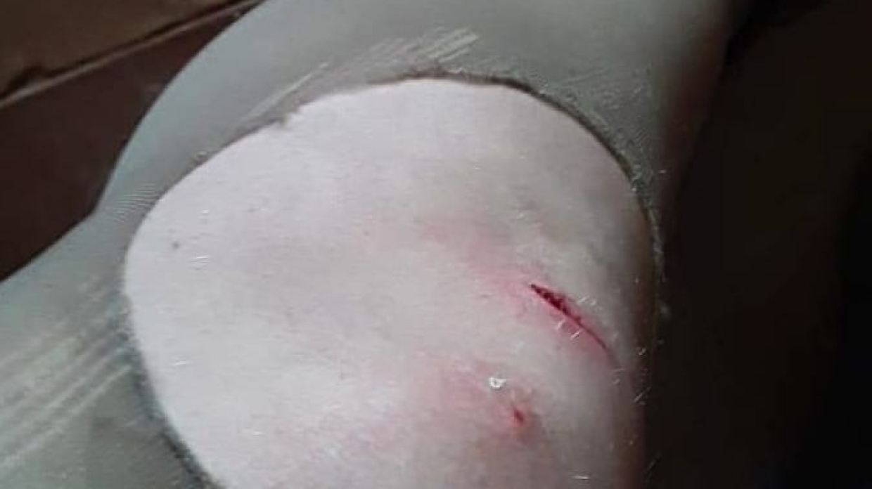 «Искусала за ноги»: в Приморье на детей нападают собаки