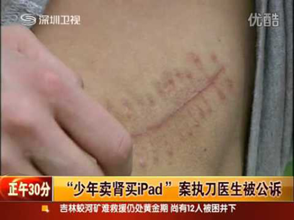 Китаец продал почку, чтобы купить смартфон, и пожалел об этом Китаец продал почку, чтобы купить смартфон, и пожалел об этом