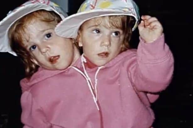 15 интересных фактов о сиамских близняшках Хенсел