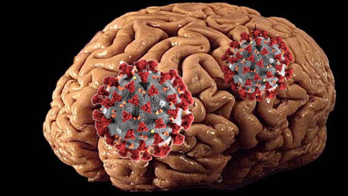 Поражение головного мозга. Коронавирус проникает в мозг.