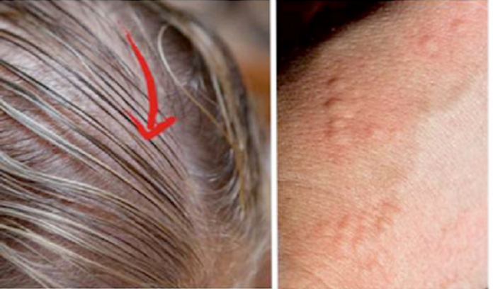 8-signs-that-indicate-problem-with-thyroid-gland-696x408
