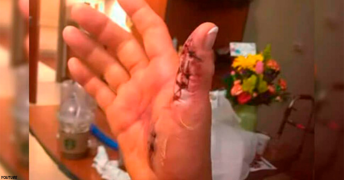 Она пришла сделать маникюр - и чуть не потеряла руку от плотоядных бактерий