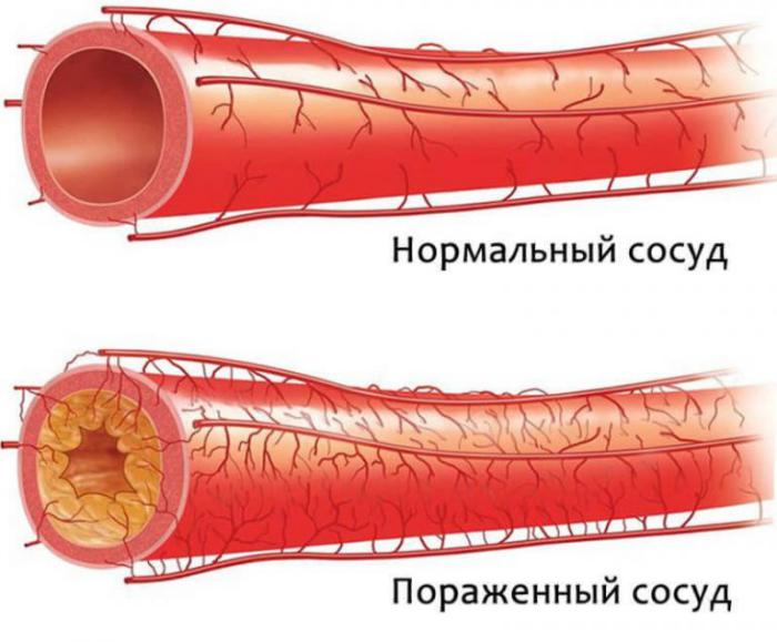 Какой сосуд поврежден на рисунке 1