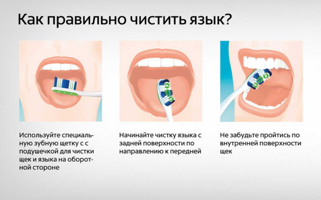 Как почистить зубы без. Как правильно чистить язык. Правильная чистка языка. Чистка языка зубной щеткой.