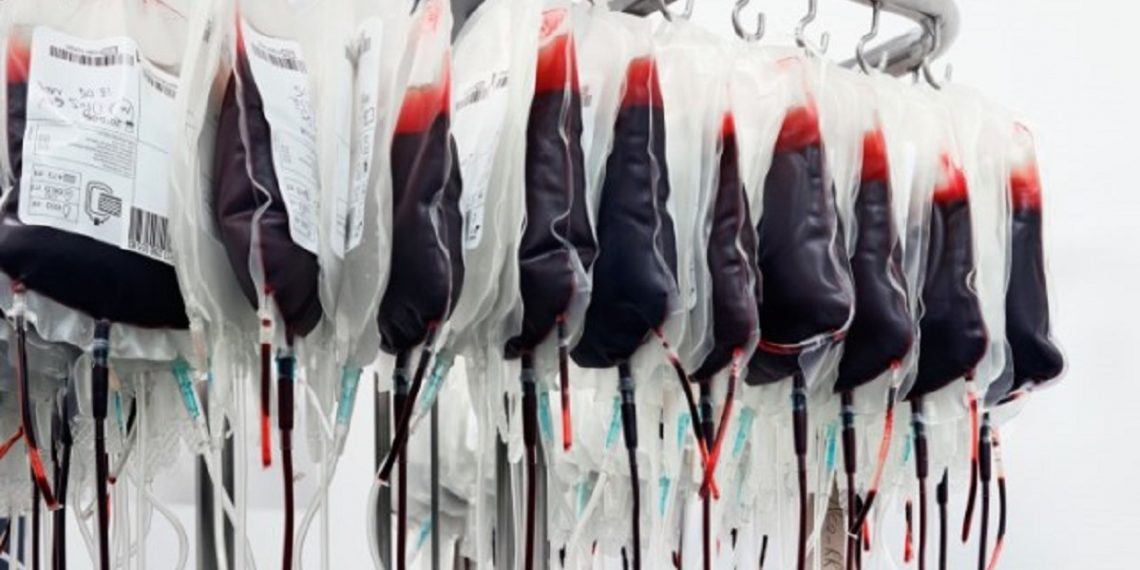 Какие бывают группы крови у людей, и что такое «золотая» кровь