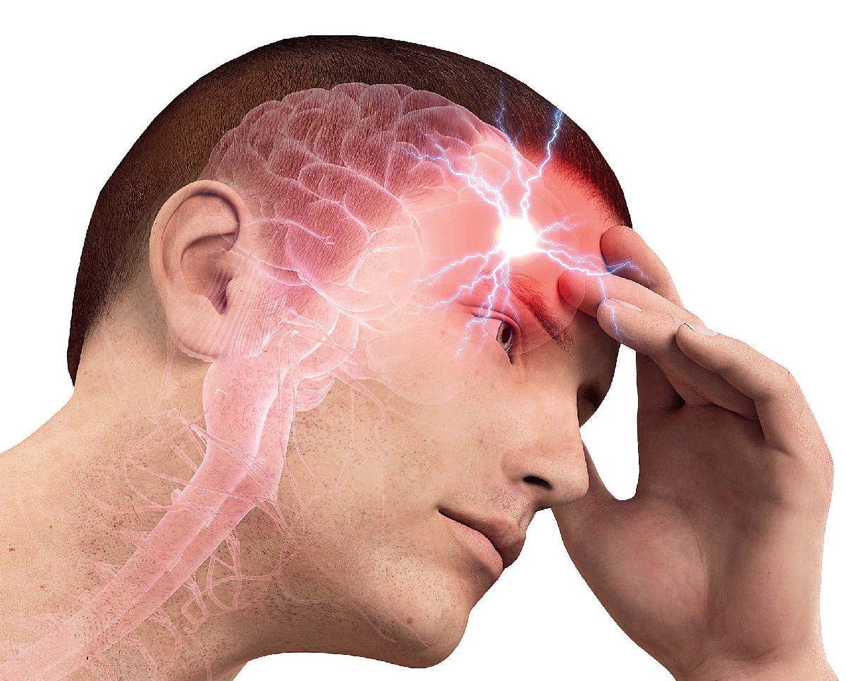 Заболевание сосудов мозга. Головная боль. Головная боль мигрень. Что такое мигрень головы.