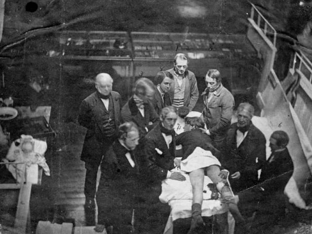Шокирующие факты о викторианской хирургии 