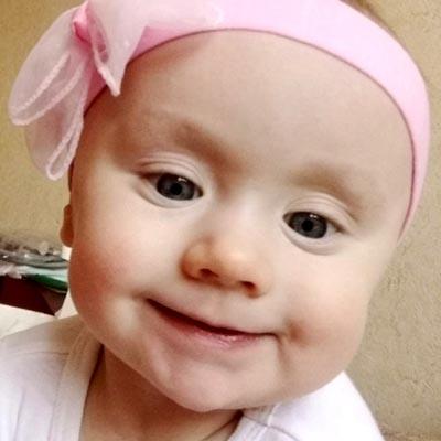 Алипия Литвиненко, 10 месяцев, врожденная правосторонняя косолапость, требуется лечение по методу Понсети, 115 566 ₽