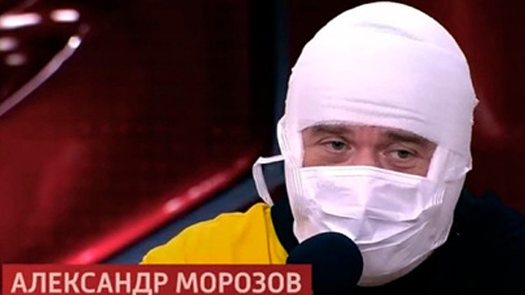 Звезда «Кривого зеркала» Морозов появился на публике с перебинтованной головой Звезда «Кривого зеркала» Морозов появился на публике с перебинтованной головой Шоу-бизнес