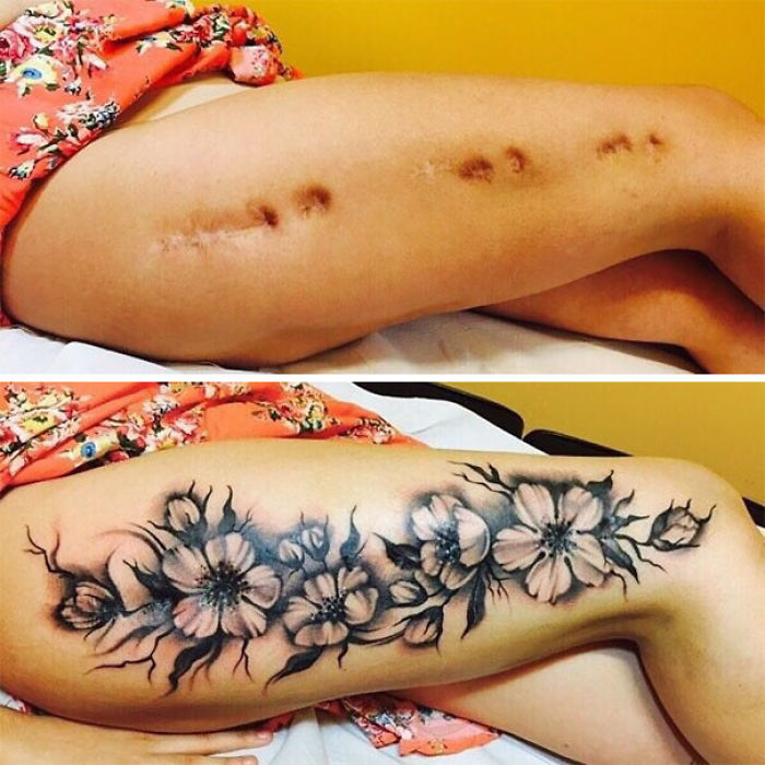 Scars Tattoo Cover Up