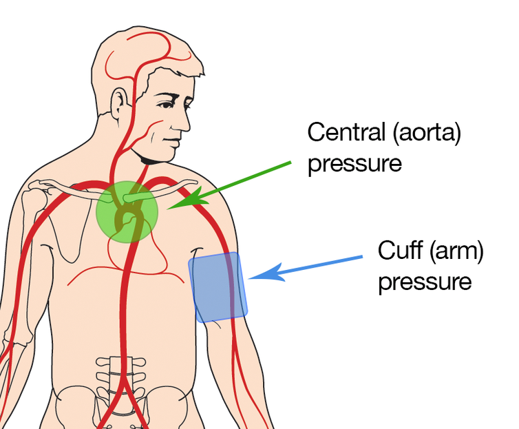 Ошибки при измерении артериального давления