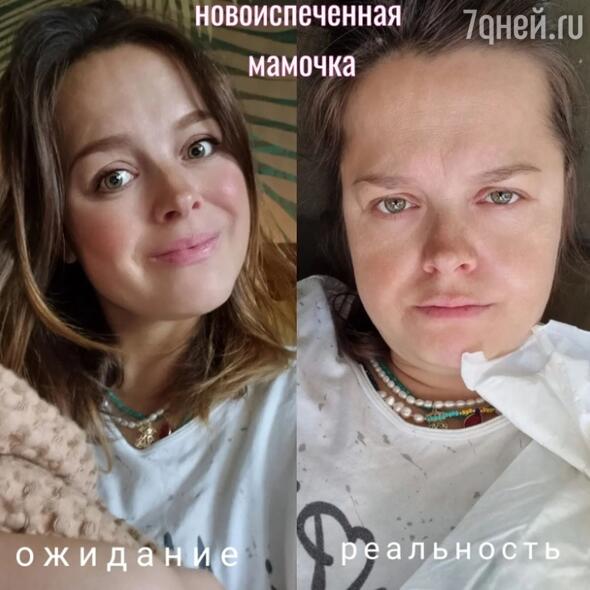 Отеки и морщины: родившая Медведева показала себя без прикрас