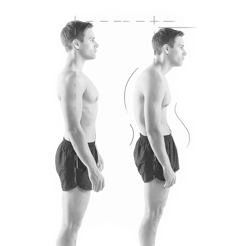 Правильная осанка позвоночника