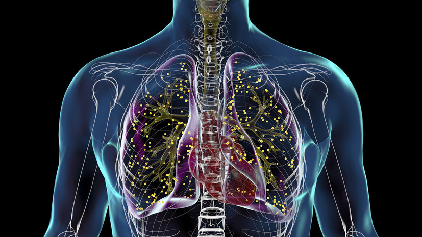 Врач Уланкина: туберкулёз на раннем этапе легко спутать с гриппом