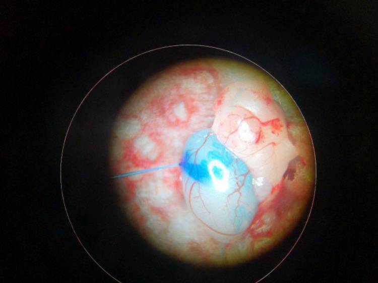 Программист-биохакер, разбогатевший на биткоинах, планирует создавать дизайнерских младенцев Программист-биохакер, разбогатевший на биткоинах, планирует создавать дизайнерских младенцев биохакер