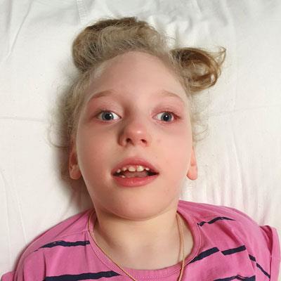 Поля Тащенко, 9 лет, детский церебральный паралич, эпилепсия, требуется лечение, 141 023 ₽