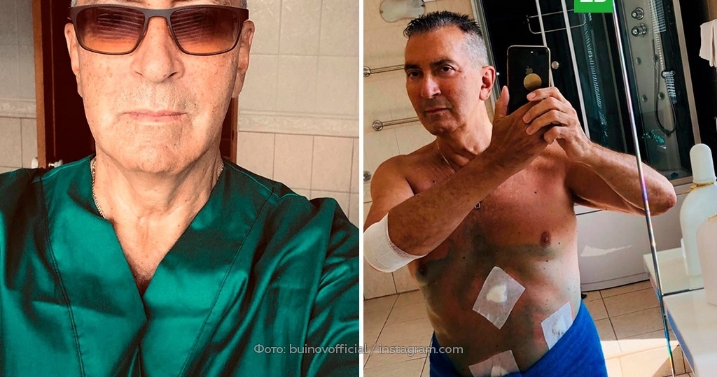 Жена напугавшего худобой Буйнова раскрыла, какую операцию сделали певцу