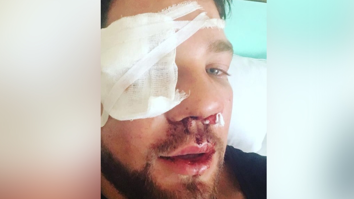 Олимпийский чемпион из Дагестана извинился за земляков, избивших мужчину в метро Происшествия