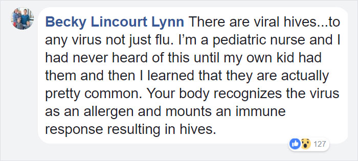 son-flu-symptom-hives-influenza-brodi-willard-10