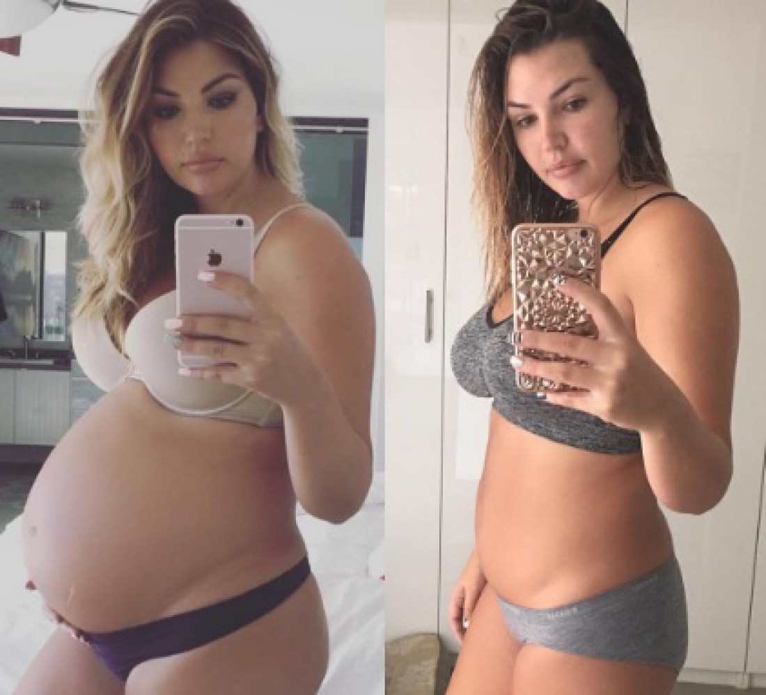 грудь после беременности и родов фото до и после фото 68