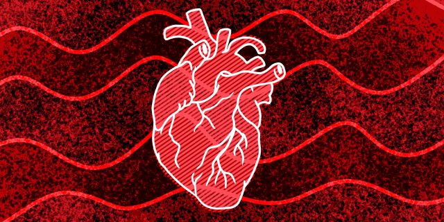 11 признаков того, что у вас может случиться остановка сердца болезни,здоровье,медицина,сердечно - сосудистые заболевания,симптомы