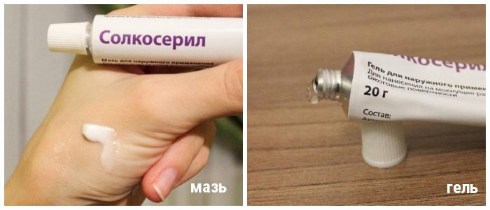 Поможет ли Cолкосерил мазь от морщин: мнение косметологов и отзывы женщин Поможет ли Cолкосерил мазь от морщин: мнение косметологов и отзывы женщин