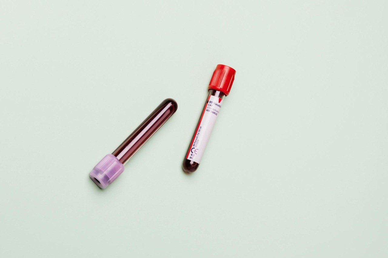 Фото: https://unsplash.com/