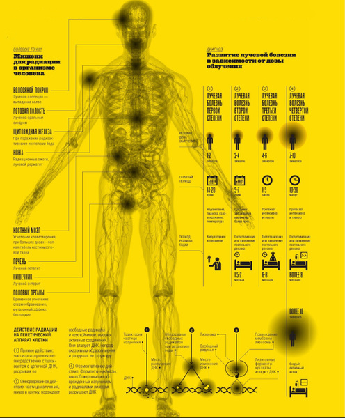 Излечение от излучения: что такое лучевая болезнь и как радиация влияет на человеческий организм