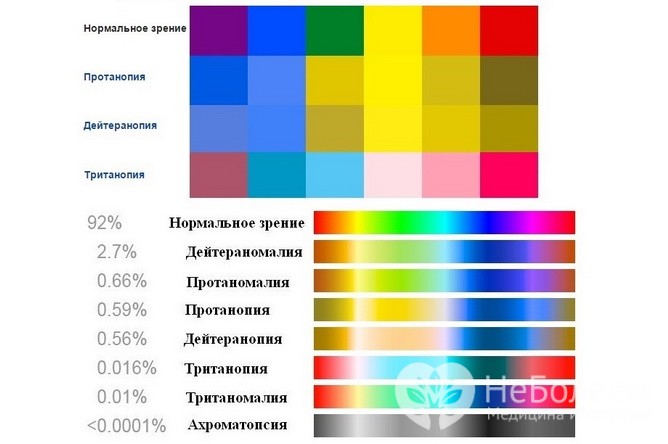 Дальтонизм: виды цветослепоты