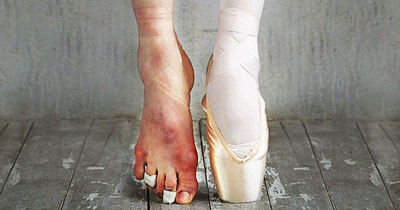 Цена аплодисментов! Эти 15 кадров доказывают, что балет не для слабаков Цена аплодисментов! Эти 15 кадров доказывают, что балет не для слабаков балет