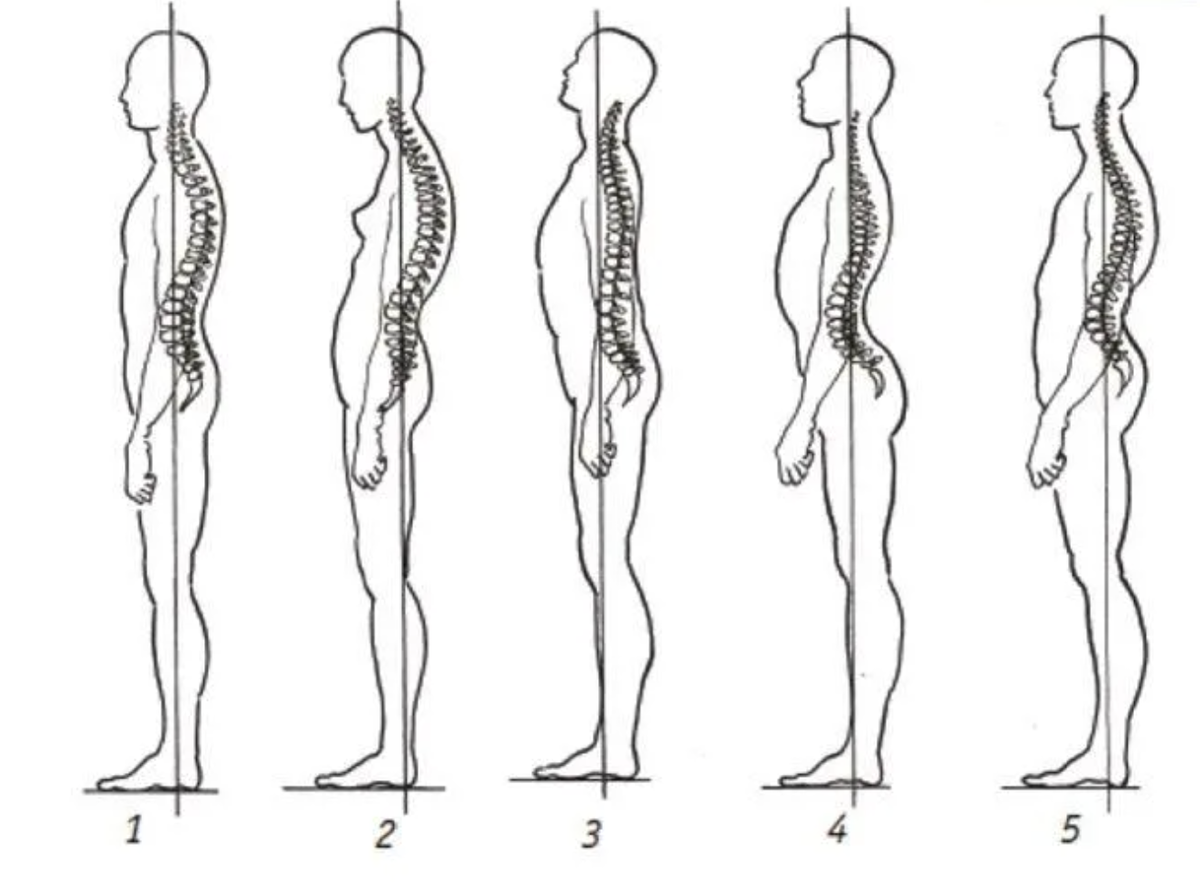 Какая осанка у вас?