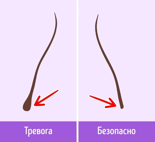 Почему выпадают волосы и как это остановить