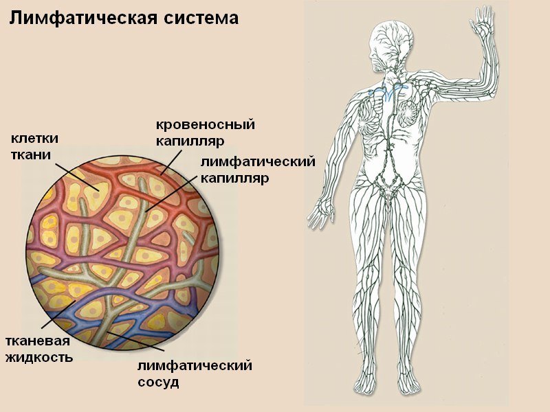 Механизмы нарушения лимфообращения схема