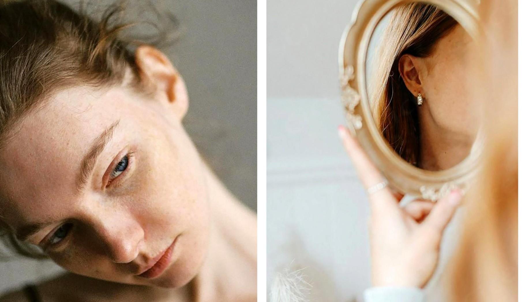 Правда ли, что пластику ушей можно делать до 18 лет: все, что вы хотели знать об отопластике Правда ли, что пластику ушей можно делать до 18 лет: все, что вы хотели знать об отопластике format-article,noindex,Вопрос эксперту,ольга чернова,семейная,клиника