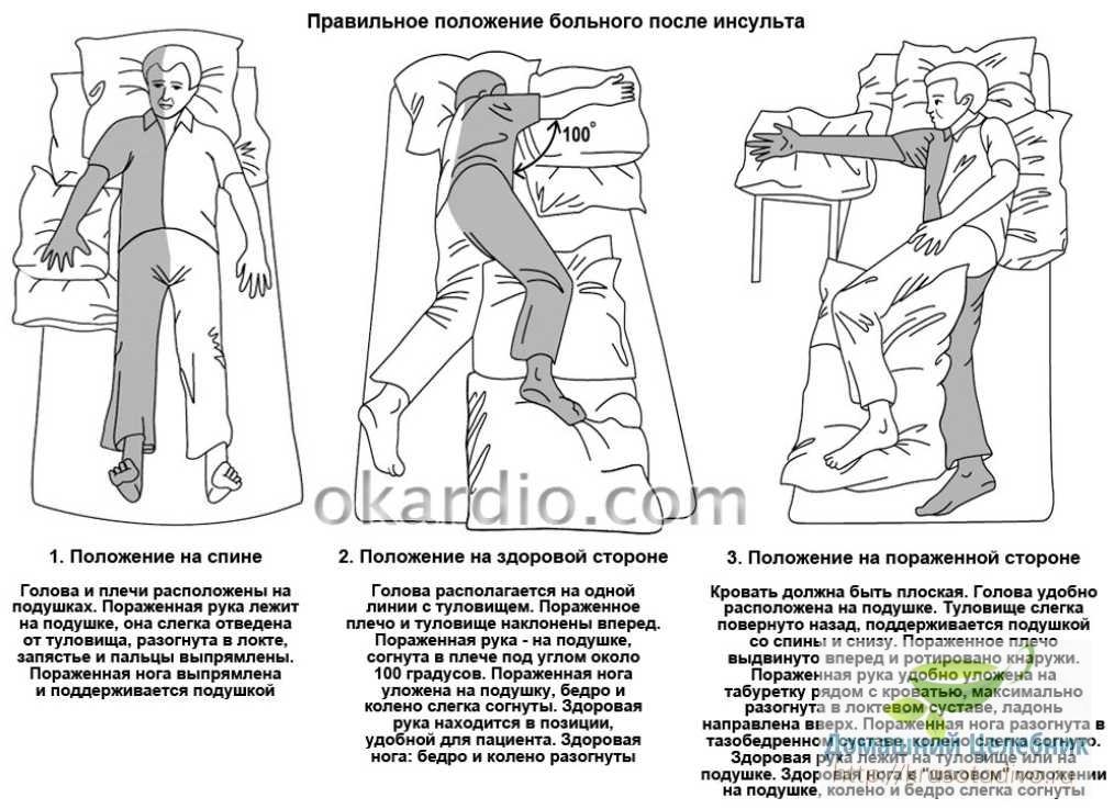 После инсульта форум. Массаж при параличе правой стороны после инсульта. Положение больного после инсульта. Укладка пациентов после инсульта. Поза лежачего больного после инсульта.