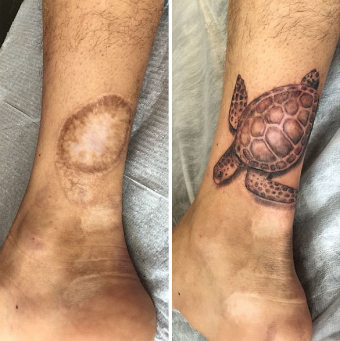 Scars Tattoo Cover Up