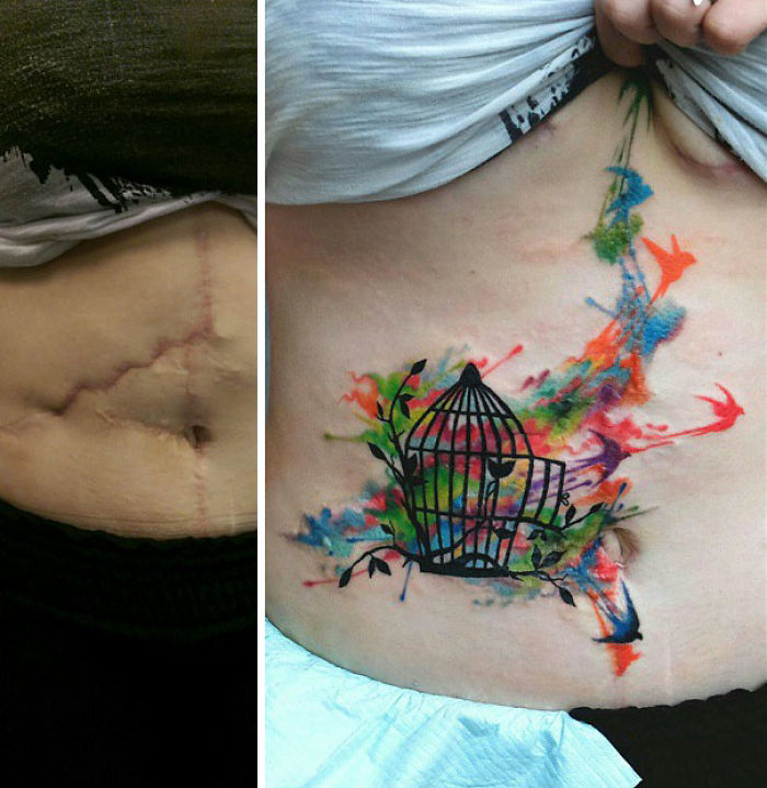 Scars Tattoo Cover Up