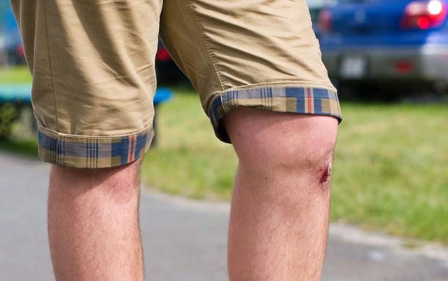 8 способов разрушить свои колени болезни,здоровье,колени,коленный сустав,спорт